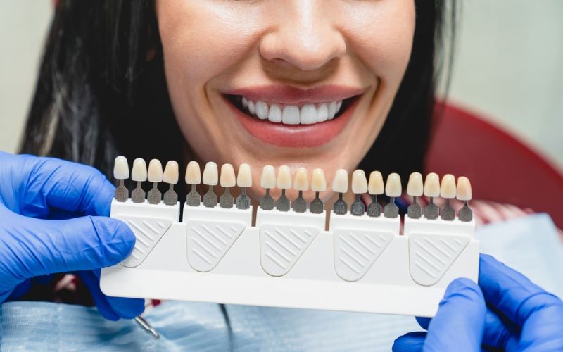 dental veneers in chicago il