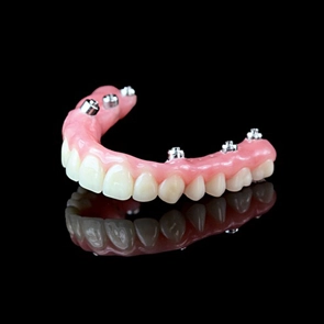 implant crown and bridge Chicago IL