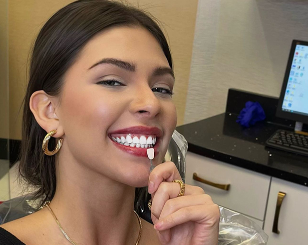 The tooth enamel colour is chosen by the girl in the Lux Smiles office