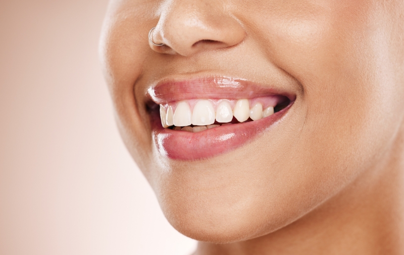 Is Cosmetic Dentistry Right for You A Chicago Prosthodontist Answers Your FAQs