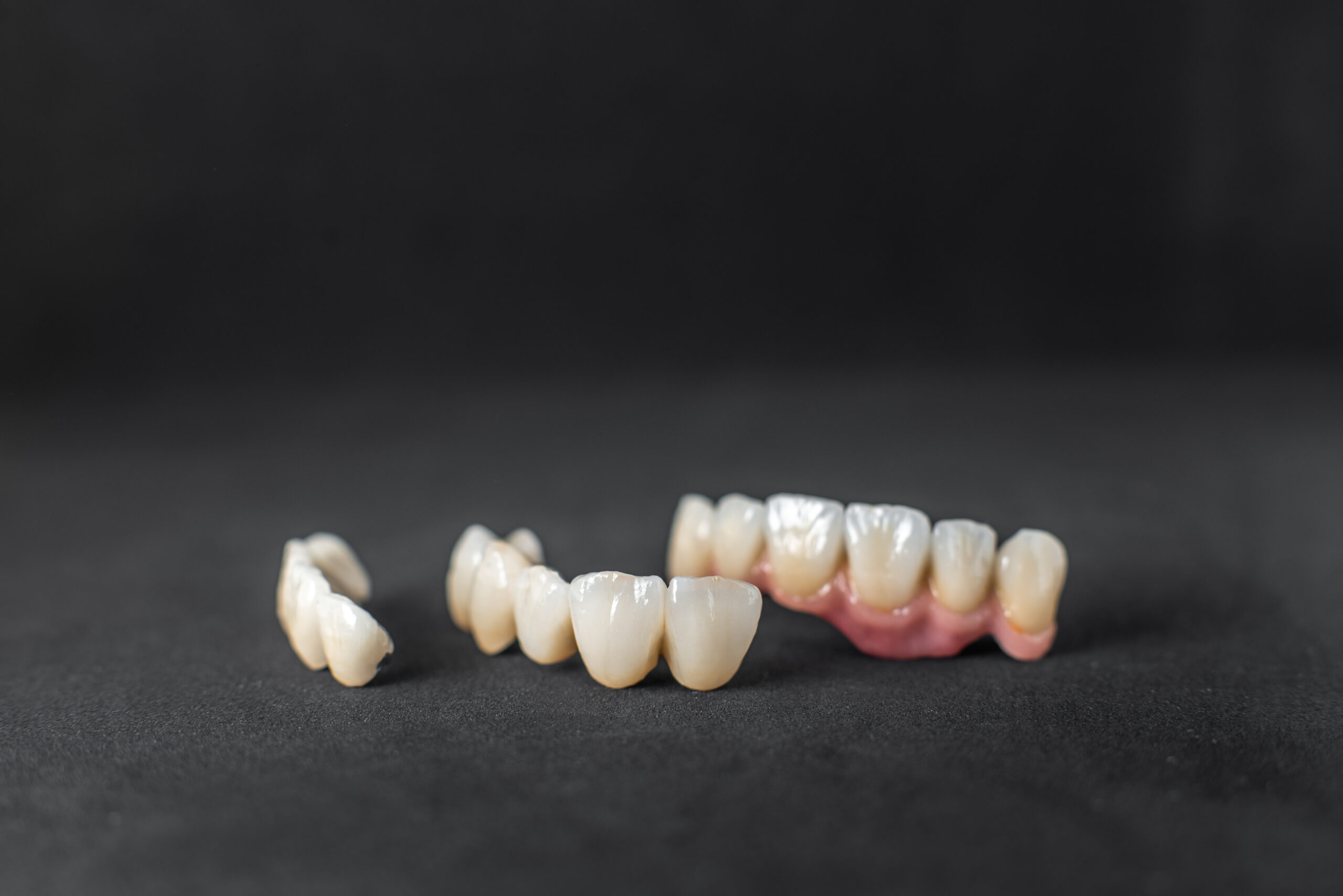 Close-up on dental crowns on the black background. Concept of prosthetics and implantation in dentistry